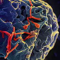 Sulla superficie di una cellula VERO stanno gemmando particelle virali di virus Ebola