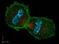 Telofase in cellula di topo. La foto è ottenuta grazie ad immunocolorazione. Le fibre del fuso sono arancioni, l'actina è verde mentre i cromtidi sono colorati in ciano