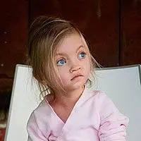 A sinistra: gruppo dibambini di diverse età affetti da sindrome del grido del gatto. A destra bambina con sindrome di Wolf