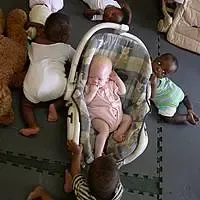 Bambino nero albino circondato da bambini normali