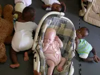 Bambino nero albino circondato da bambini normali