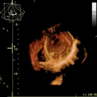 Frame di una gif animata