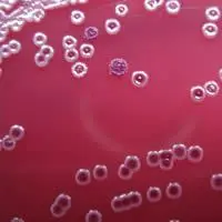 Colonie a diversa morfologia di Burkholderi pseudomallei