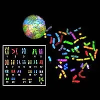 Combinazion di due immagini di cariotipi umani ottenuti con tecniche innovative