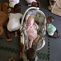 Bambino nero albino circondato da bambini normali