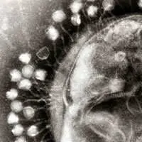 Superficie di cellula batterica attaccata da fagi. Immagine al microscopio elettronico.