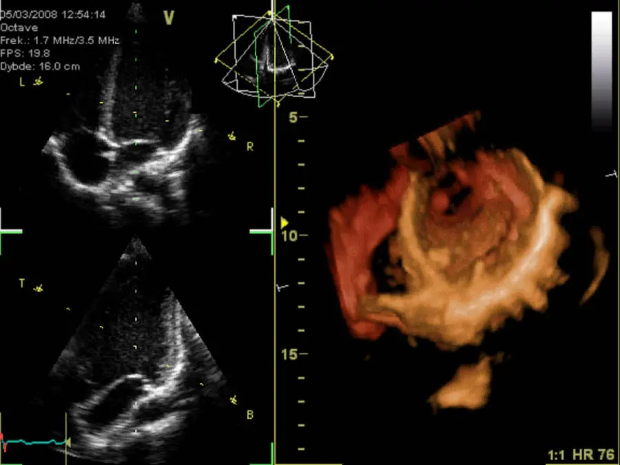 Frame di una gif animata