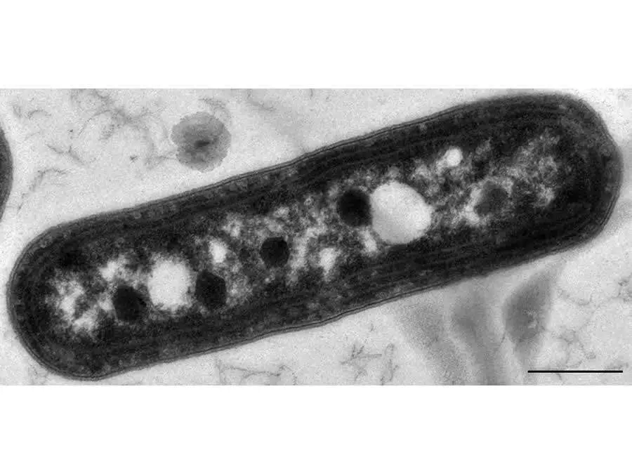 Sezione di batterio che mostra i carbossisomi, formazioni poliedriche scure